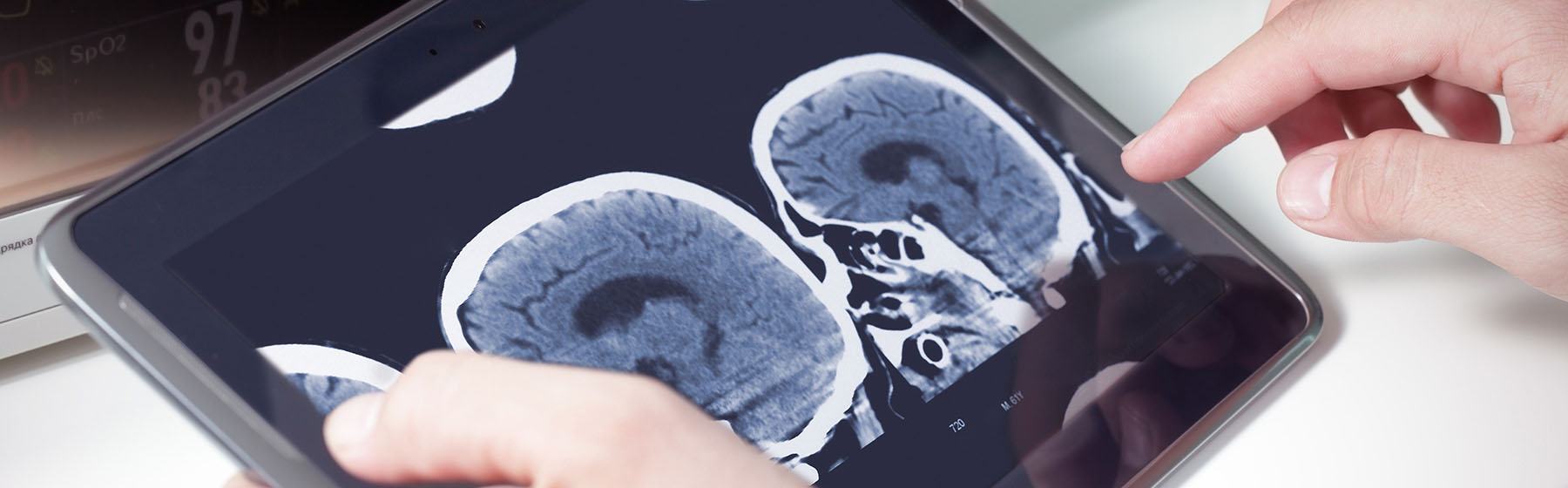 doctors hands holding tablet to review head scans